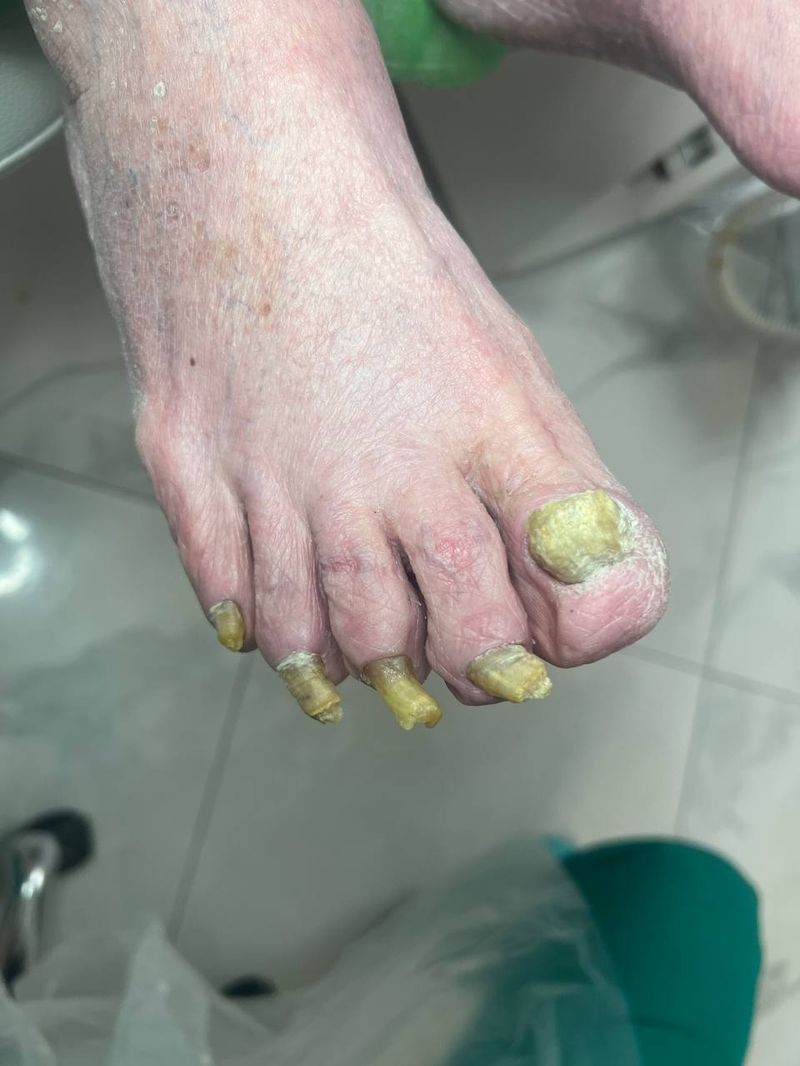 До обробки