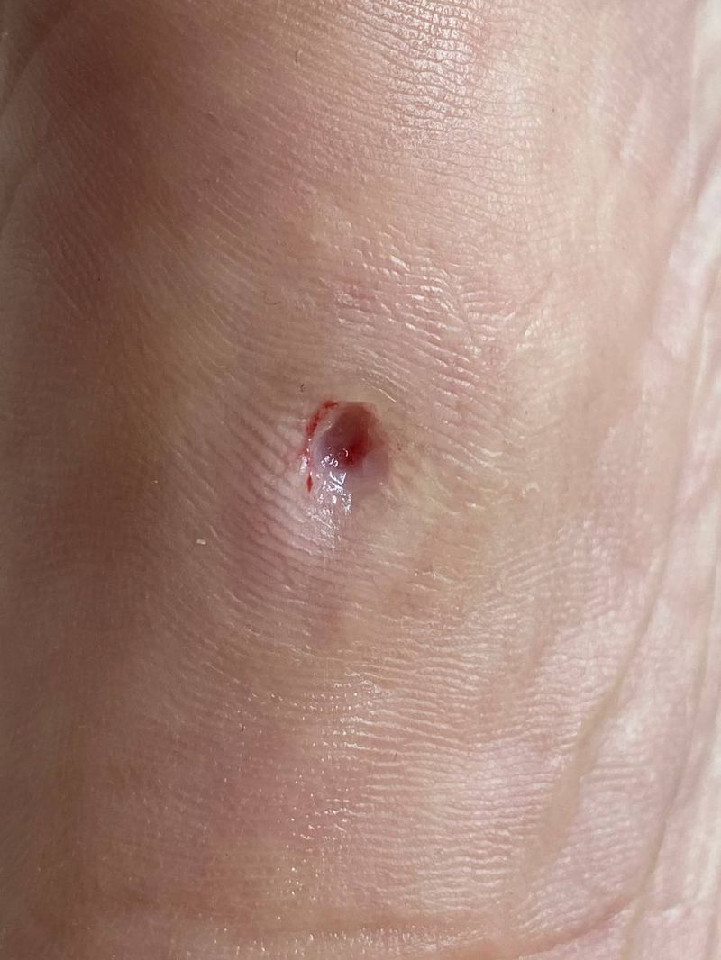 До обробки нігтя