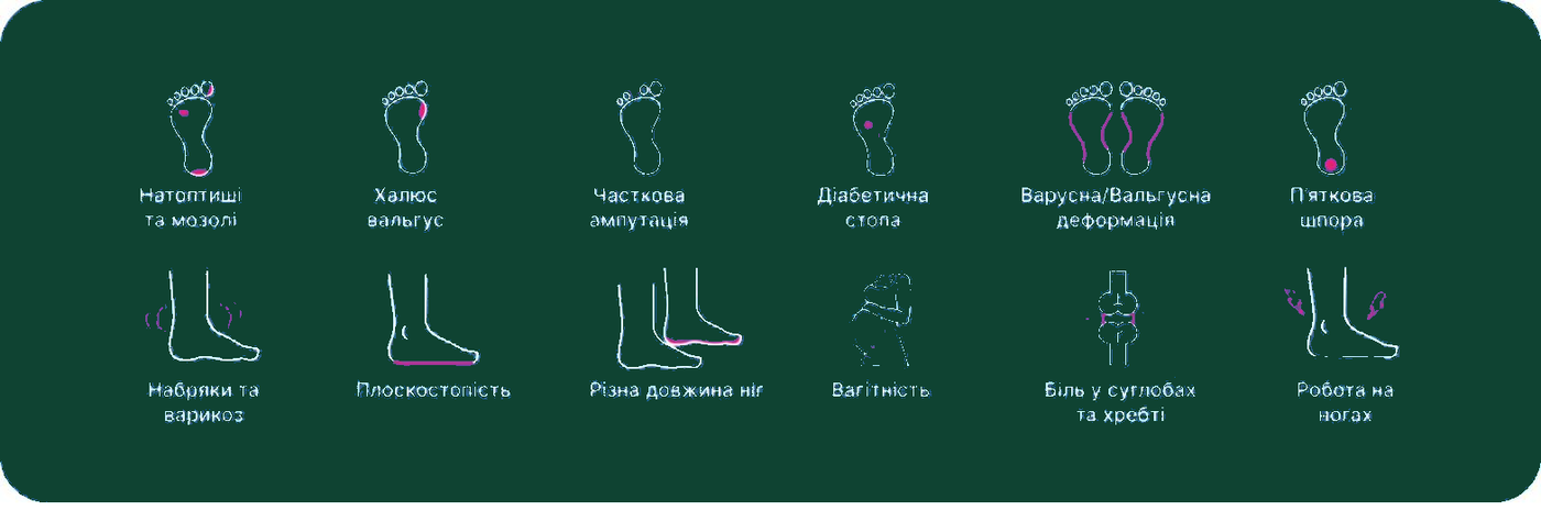 Показання для індивідуальних ортопедичних устілок